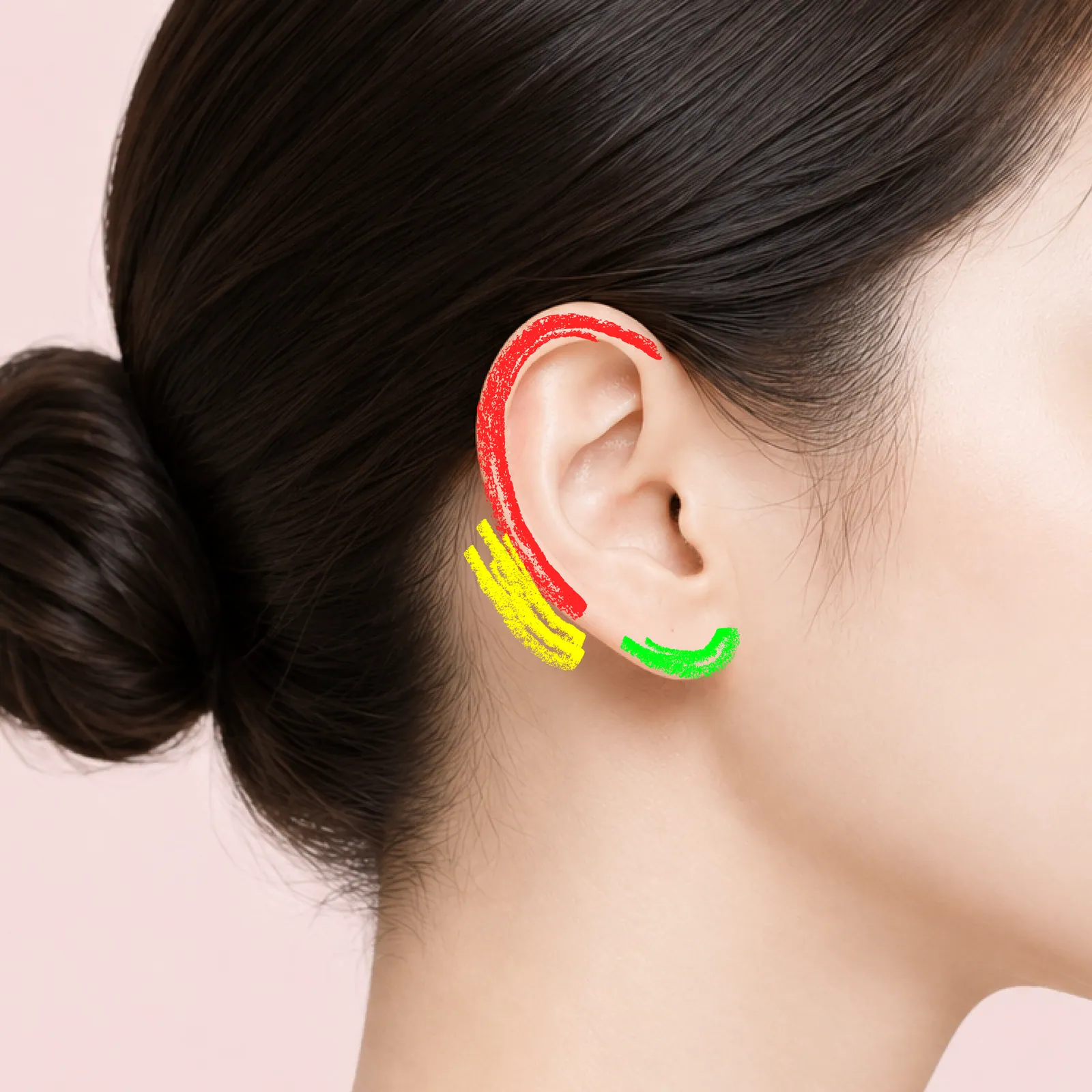 Fairy Ear Filler treatment Area