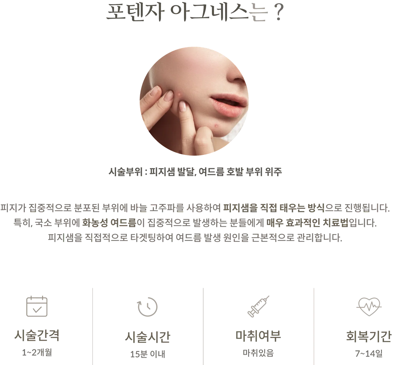 Potenza Agnes treatment Information Panel: treatment area focuses on sebaceous gland development and areas prone to acne; explanation of the method using needle radiofrequency to directly burn sebaceous glands; treatment interval 1–2 months; treatment time within 15 minutes; anesthesia applied; recovery period 7–14 days.