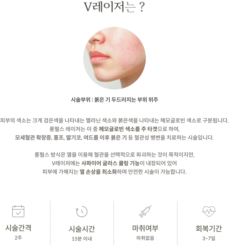 V-Laser treatment Information Panel: treatment site focusing on areas with prominent redness, explanation of long-pulse laser targeting hemoglobin pigment and sapphire cooling, treatment interval 2 weeks, treatment time within 15 minutes, no anesthesia, recovery period 3–7 days