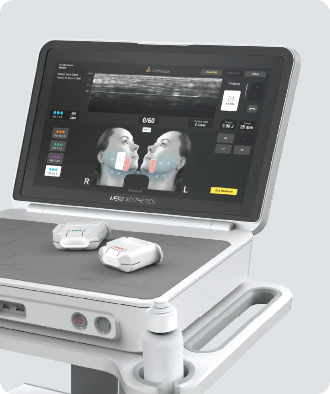 DeepSEE Real-time Ultrasound Screen