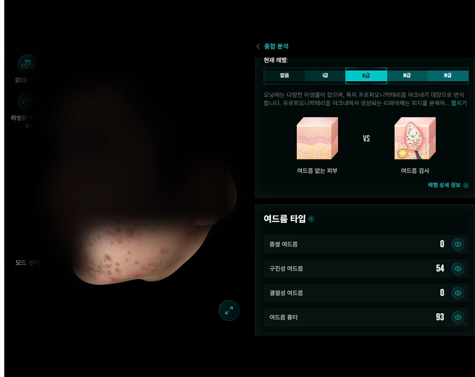 AI Skin Analysis