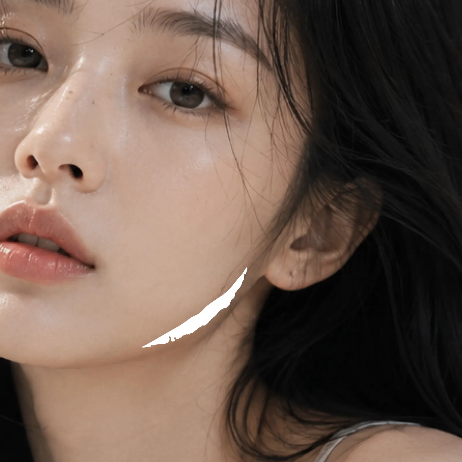 Jaw Botox