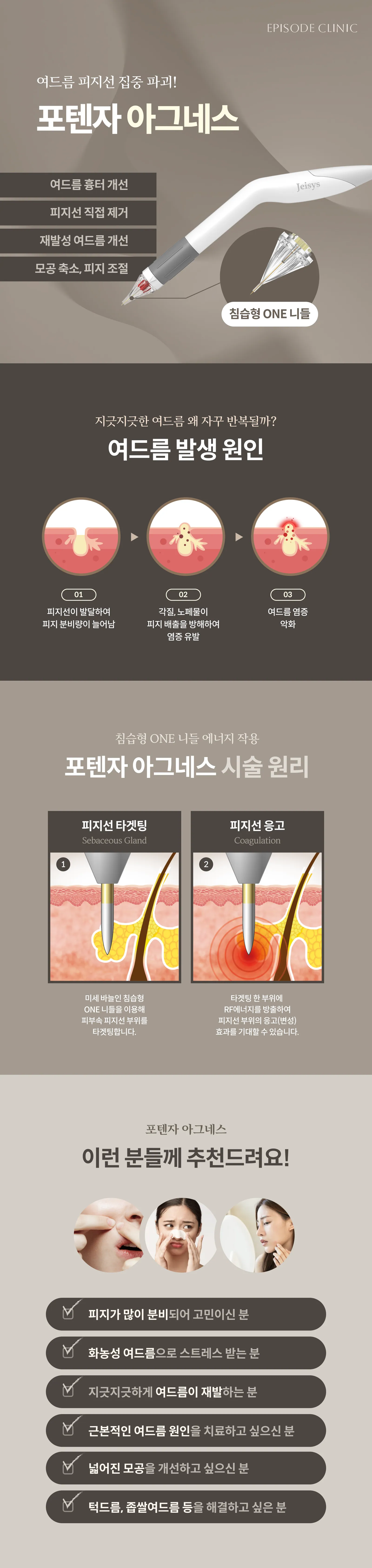 Potenza Agnes Detailed Guide: Photos of the Invasive One-Needle Device, 4 Applications, 3 Stages of Acne Causes, 2 Stages of treatment Principle (Sebum Gland Targeting, Sebum Gland Coagulation), 6 Target Groups