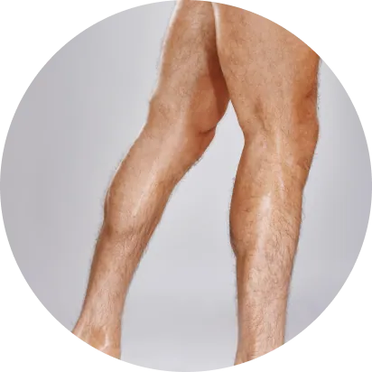 hair removal area of the entire leg