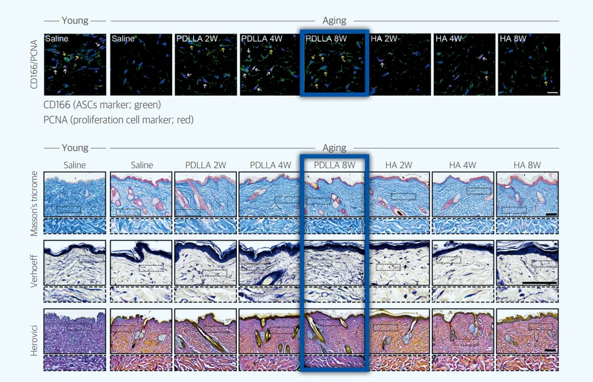 Changes in collagen and elastin fiber density over time after the treatment