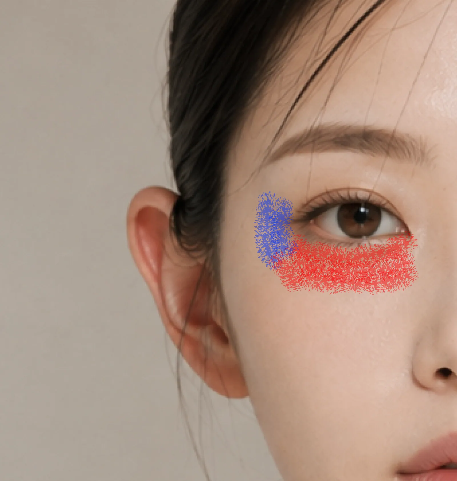Juvelook eye treatment area