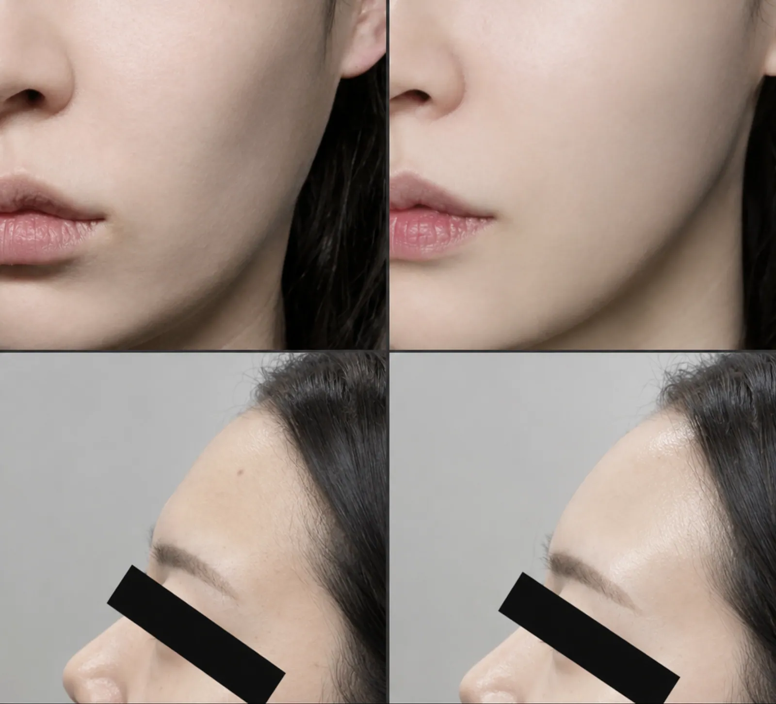 Curvature deviation before and after the treatment