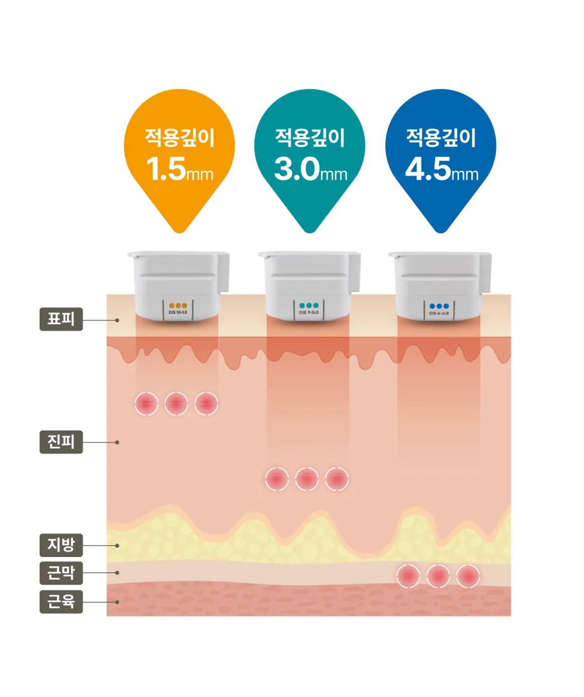 Eye area application depth diagram